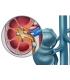 herbensurina renal sirve para cólico riñón